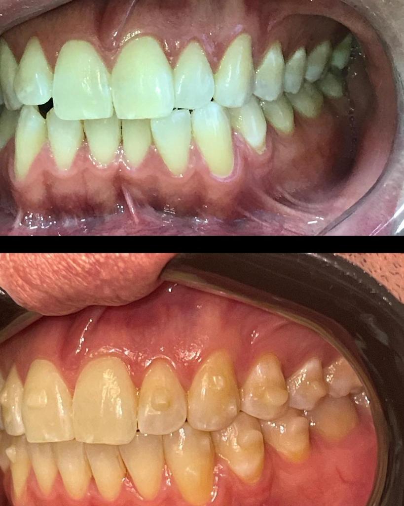 WhatsApp Image 2022-03-21 at 20.08.14 (3)