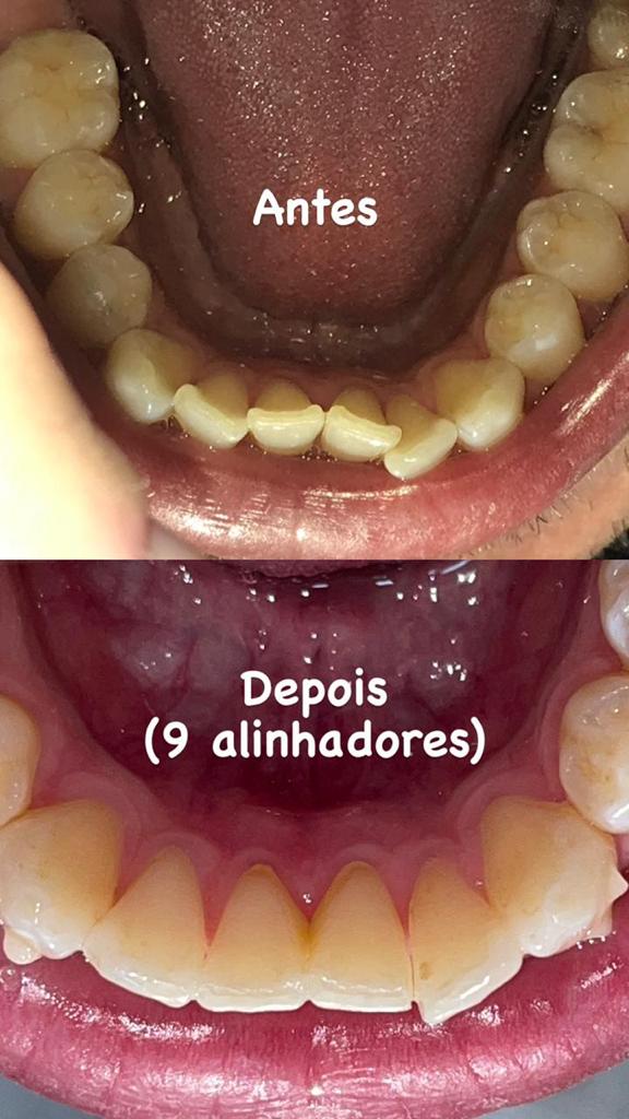 WhatsApp Image 2022-03-21 at 20.09.51 (2)