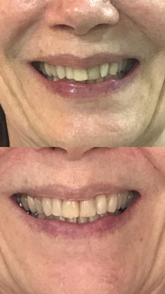 WhatsApp Image 2022-03-21 at 20.10.58 (3)